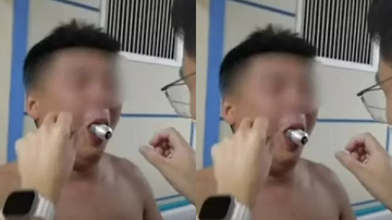 Jovem morre após aplicação de piercing na boca inflamar; entenda