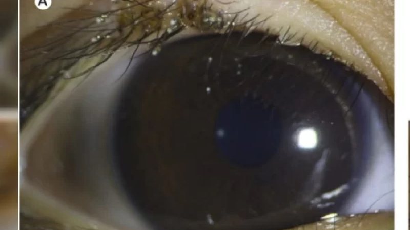 Reprodução/American Journal of Ophthalmology Case Reports