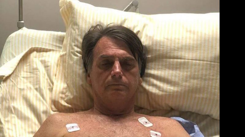 Bolsonaro Se Recupera Sem Dor E Fará Fisioterapia Neste Sábado Dizem