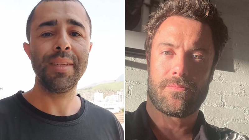 IInfluencer Bruno Diferente faz harmonização facial; veja resultado