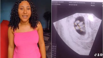 Quíntuplos de Sara dividem uma mesma placenta e bolsa gestacional - Reprodução | Redes Sociais